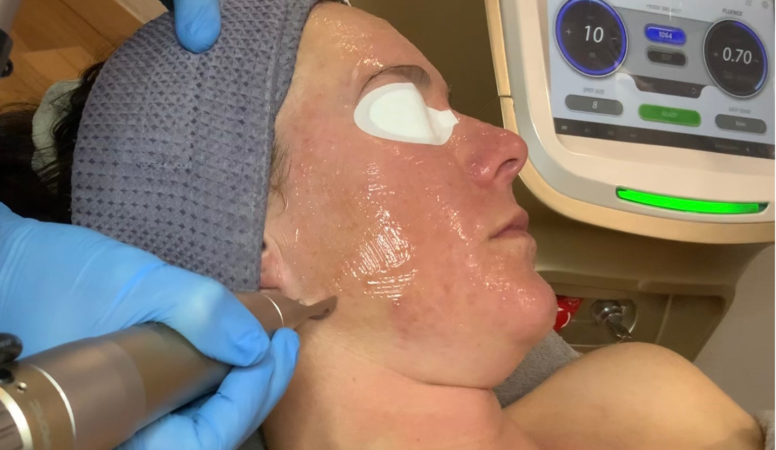 Client facial care