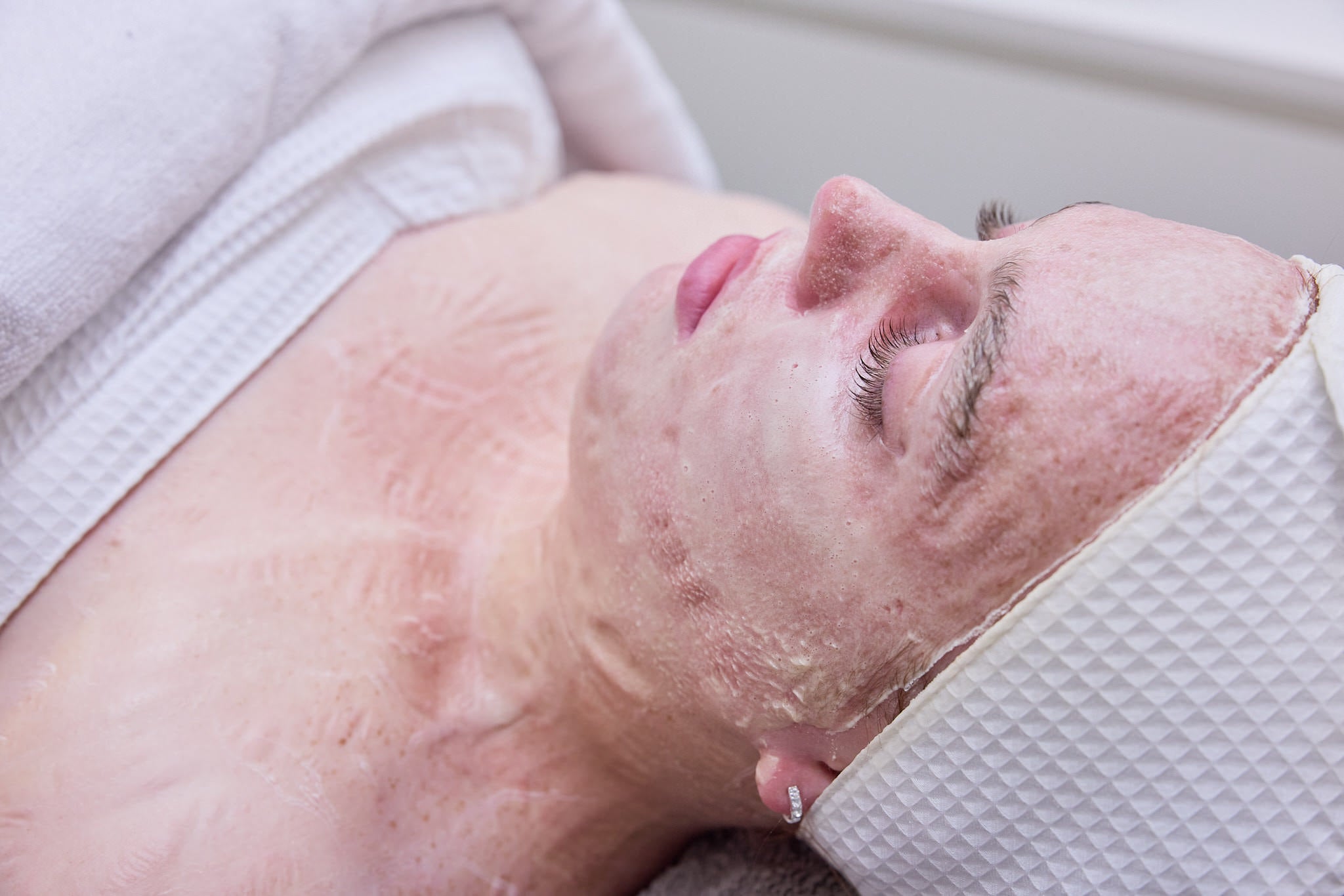 Level 3: Skin Revision 75 mins