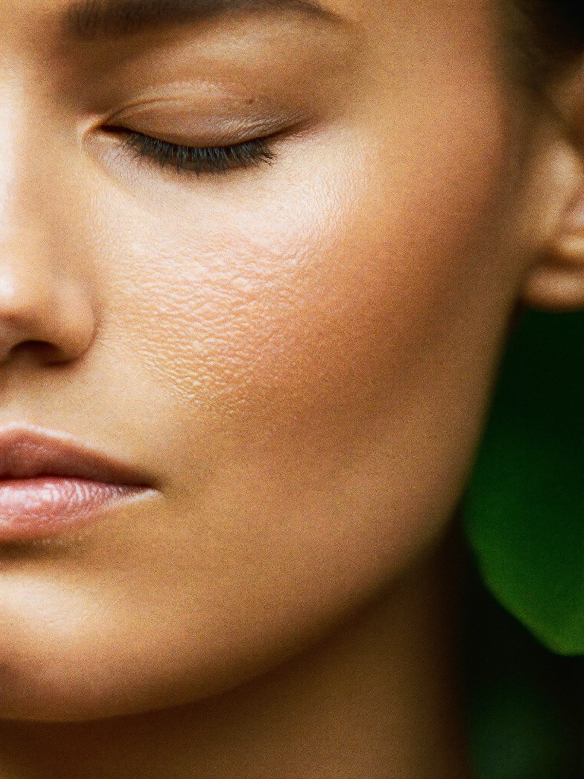 Cosmelan Pigmentation Treatment
