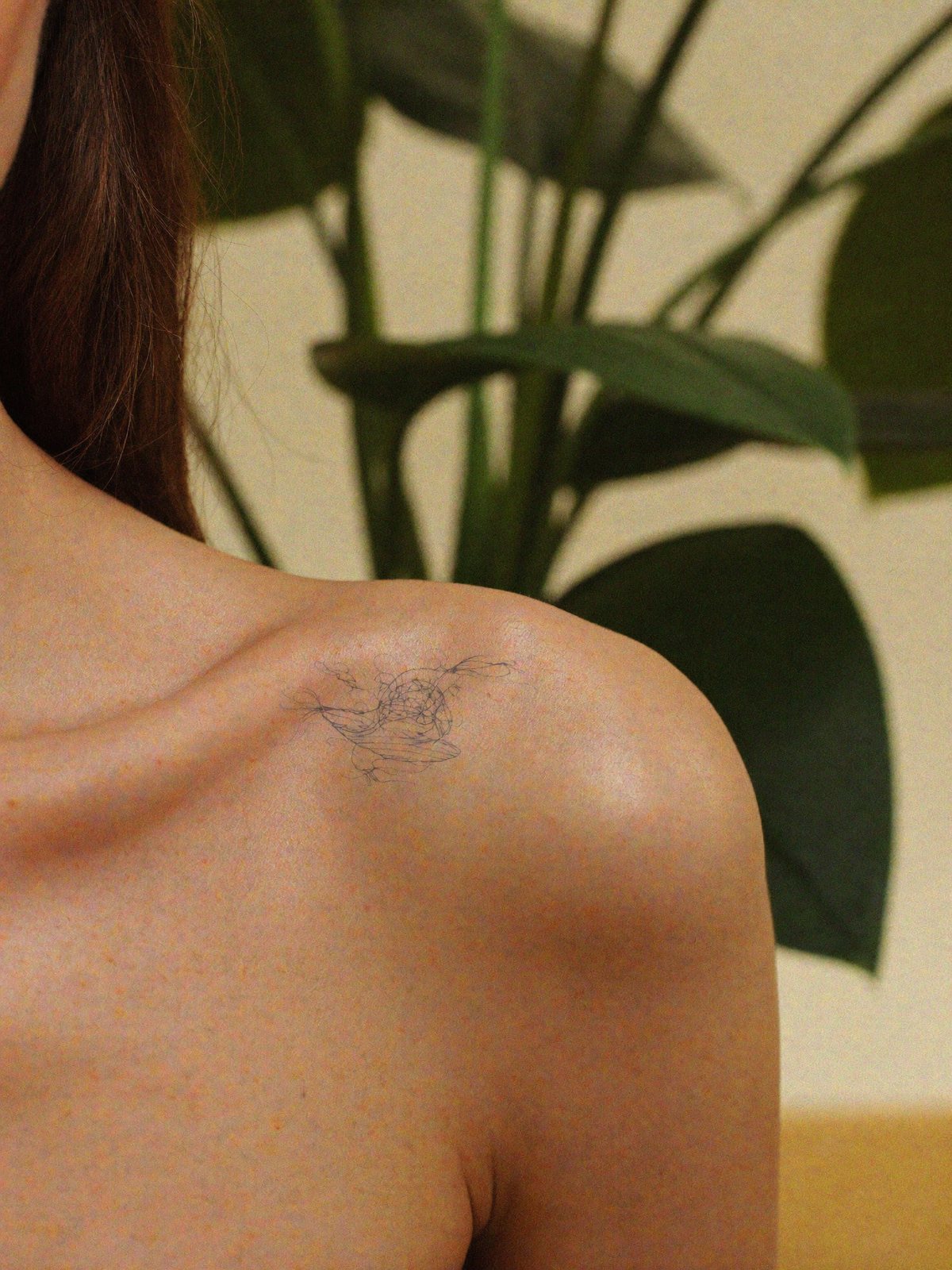 Pico Laser Tattoo Removal
