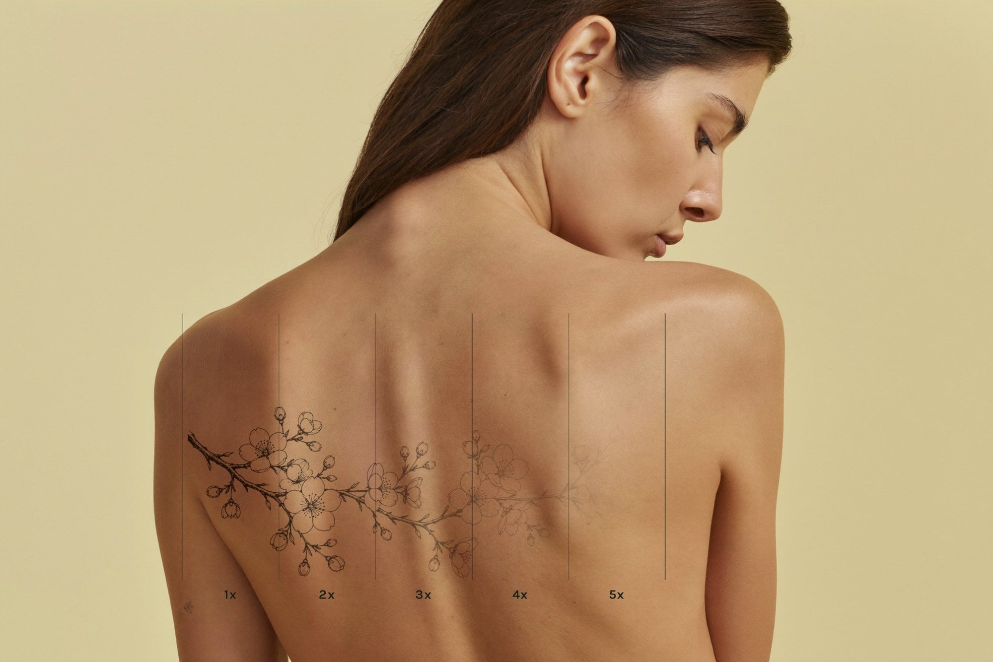 Pico Laser Tattoo Removal
