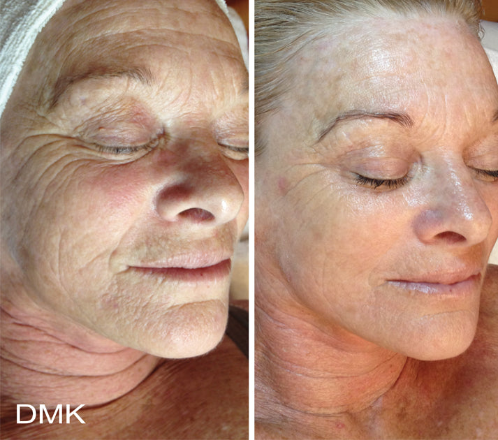 DMK Enzyme Facial - Level 4