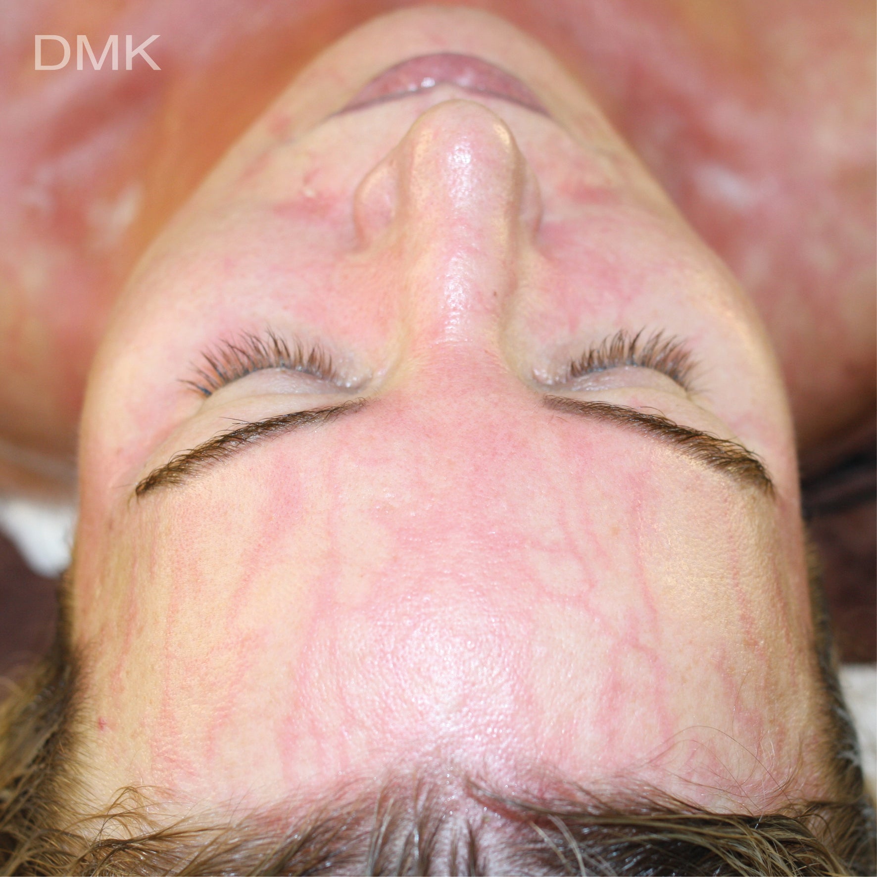 DMK Enzyme Facial - Level 1