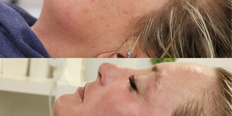 Pico Glow Package