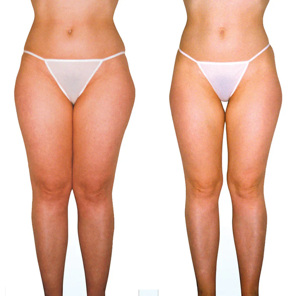 Spring Body Bootcamp