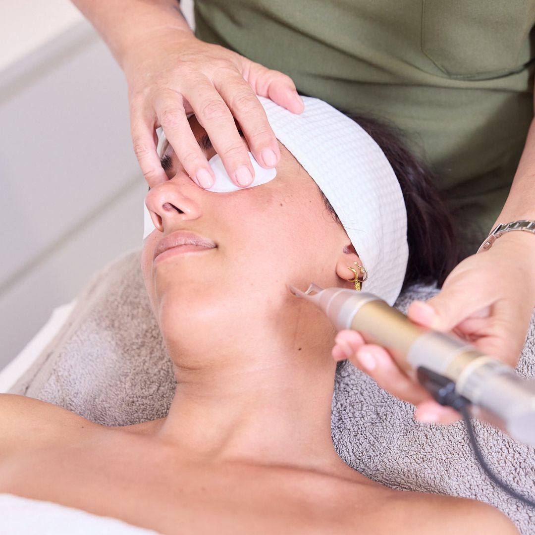 Microdermabrasion Facial - 45 mins