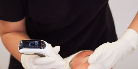 Level 4 Skin Needling with Exosomes