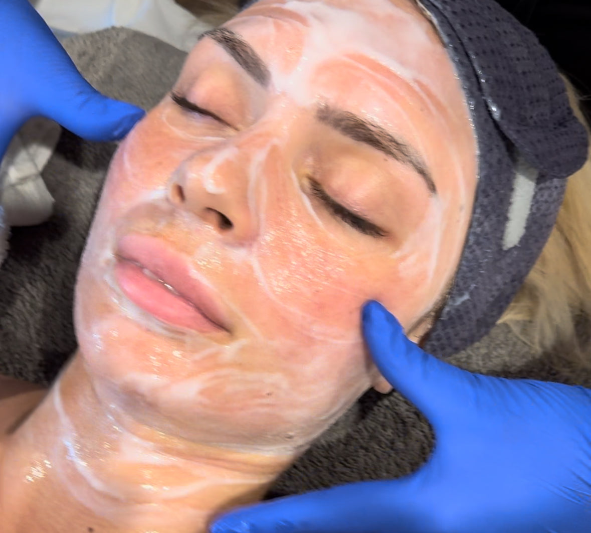 Oxygen RX Treatment