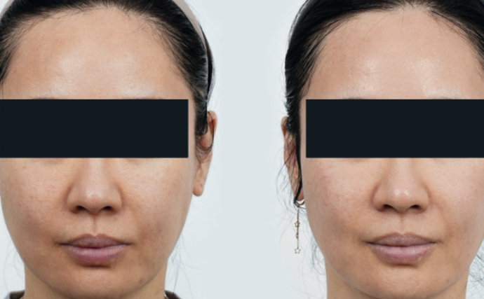 Glow & Firm Treatment