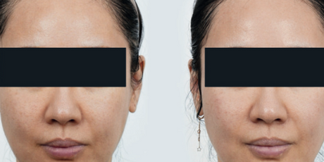Glow & Firm Treatment