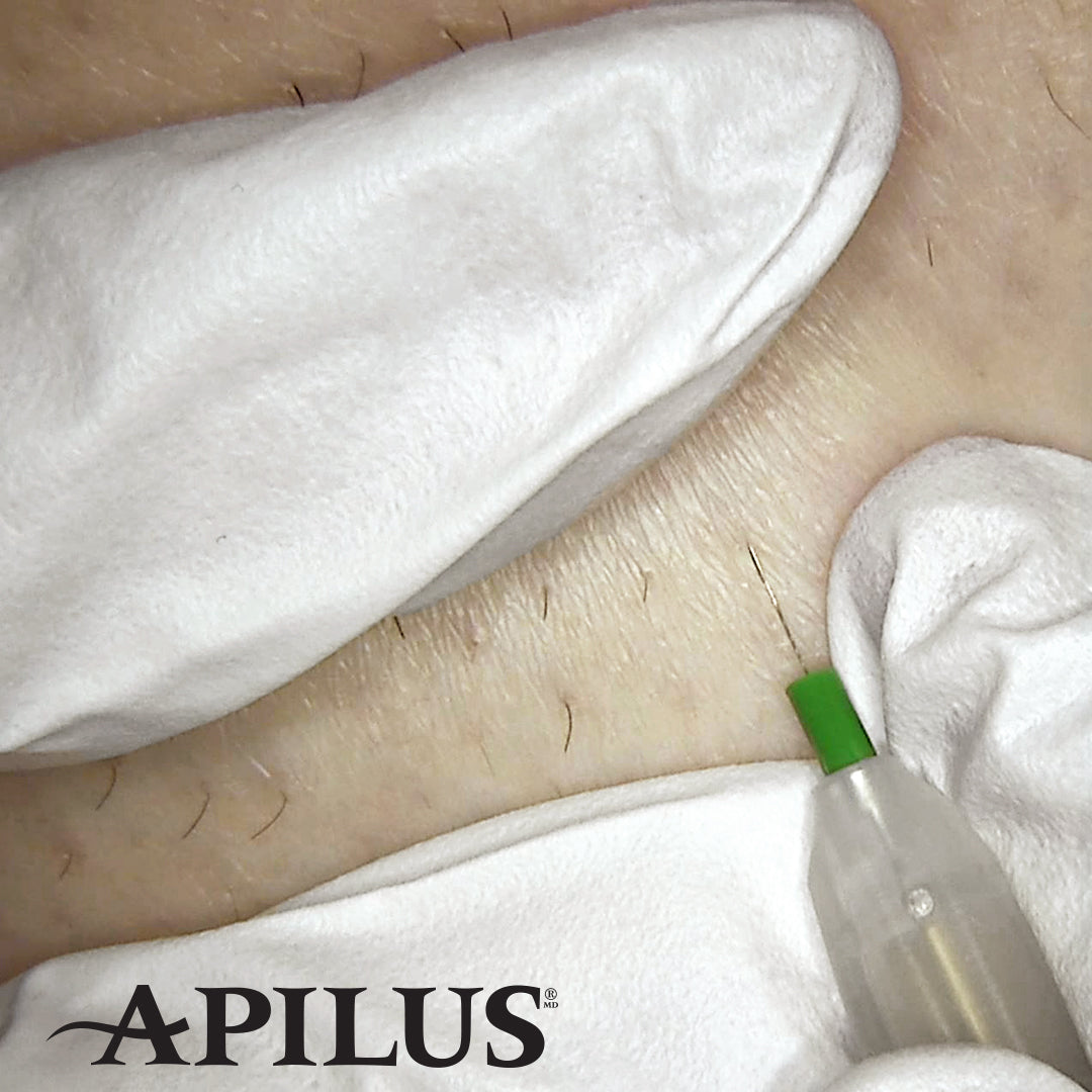 Electrolysis