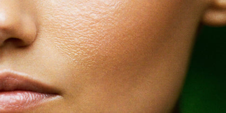 Cosmelan Pigmentation Treatment