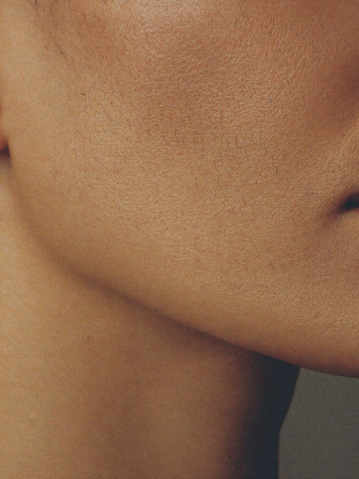 Electrolysis