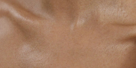 Add On: Hands / Décolletage – Skin Needling