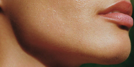 Level 1 Skin Needling