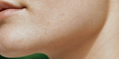 Level 4 Skin Needling with Exosomes