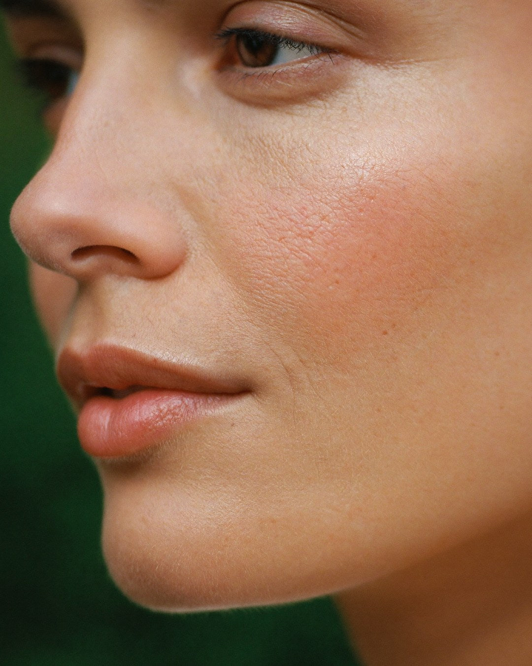 Skin Needling + Enzyme Therapy - 90 mins