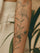 Pico Laser Tattoo Removal