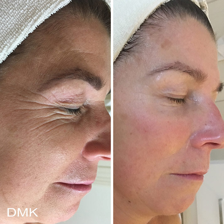 A-Lift Skin Fitness Program