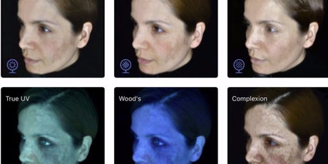 Skin Consultation