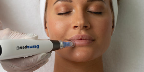 Dermapen Skin Needling