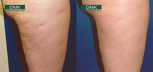 DMK Body Enzyme Therapy
