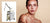 Pico Laser Skin Resurfacing
